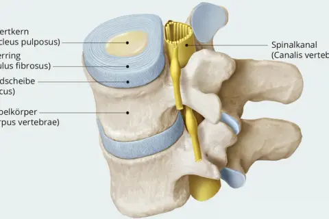 Anatomische Darstellung: wo ist die bandscheibe? Sie besteht aus Gallertkern und Faserring, eingebettet zwischen Wirbelkörpern. Der Spinalkanal verläuft dahinter.