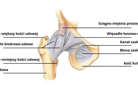 Anatomia stawu biodrowego z zaznaczonymi strukturami, w tym więzadłem biodrowo-udowym, które może wpływać na wygląd tzw. "hip dips".