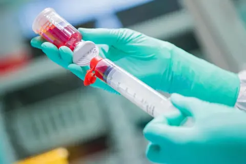Hände in grünen Handschuhen ziehen rote Flüssigkeit aus einer Ampulle in eine große Spritze. Eine Chemotherapie-Spritze wird vorbereitet.