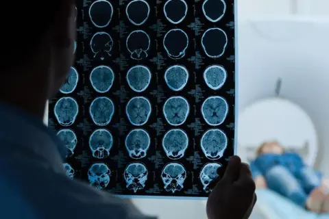 Lekarz analizuje wyniki rezonansu magnetycznego głowy, wykonanego w ramach testu na wstrząs mózgu. W tle pacjent leży w aparacie MRI.