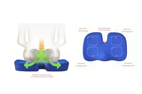 Coussin ergonomique pour soulager la névralgie pudendale. Répartit le poids pour protéger le nerf pudendal et les zones sensibles.