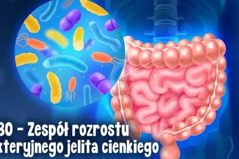 Grafika przedstawia jelita i bakterie, ilustrując problem SIBO. Objawy mogą być uciążliwe.
