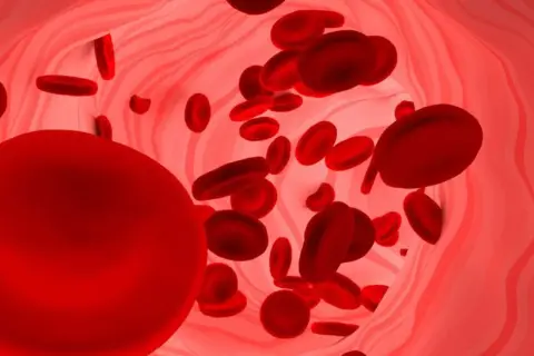 Czerwone krwinki płynące w naczyniu krwionośnym. Duża ilość erytrocytów może sugerować podwyższona hemoglobina.