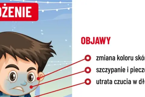 Chłopiec z bladą skórą i zmarzniętymi dłońmi, objawy odmrożenia: bladość, pieczenie, utrata czucia.