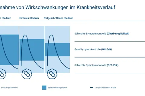 Grafik zeigt L-Dopa-Konzentration im Blut über die Zeit bei Parkinson. Mit zunehmendem Krankheitsverlauf (10 Jahre) werden die Schwankungen größer.