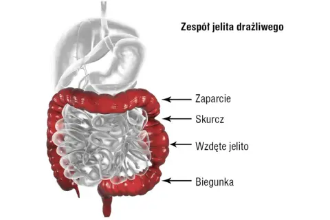 Zaburzenia motoryki jelit: objawy, przyczyny i kiedy szukać pomocy