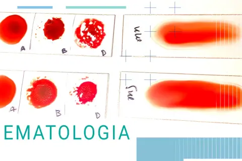 Zaburzenia hematologiczne co to - objawy, przyczyny i leczenie