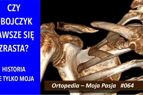 Trójwymiarowy obraz obojczyka i łopatki, z tekstem "CZY OBOJCZYK ZAWSZE SIĘ ZRASTA?".