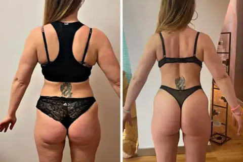 Prima e dopo: la trasformazione di una donna con glutei perfetti, più tonici e scolpiti.