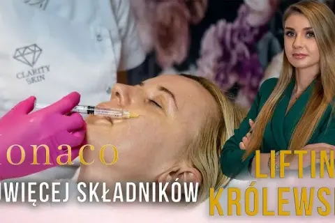 Koktajl Monako przed i po: co musisz wiedzieć o efektywnym zabiegu