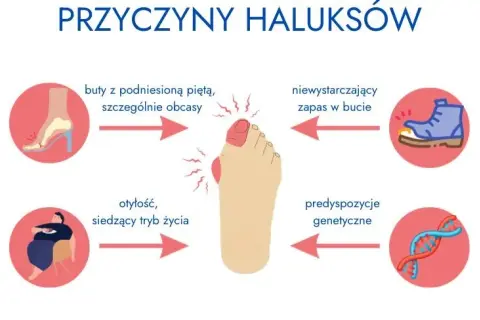 Czy haluksy są dziedziczne? Geny, buty i profilaktyka