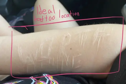 Brazo con cicatrices, rodeado por un marco rosa. El texto escrito en rosa dice "Ideal tattoo location".