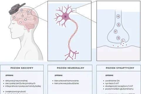 Ilustracja pokazuje schemat działania terapii TMS na mózg, neuron i synapsę, wyjaśniając zmiany na poziomie sieciowym, neuronalnym i synaptycznym.
