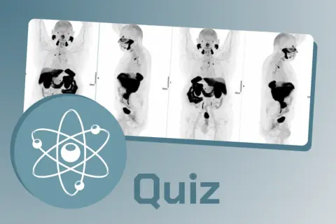 Images de médecine nucléaire, montrant des scans corporels en coupe. Un symbole atomique et le mot "Quiz" sont superposés.