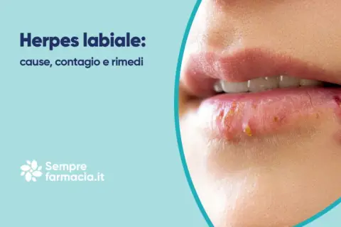 Labbra con herpes, un disturbo comune. Scopri cause, contagio e rimedi per il herpes lingua.