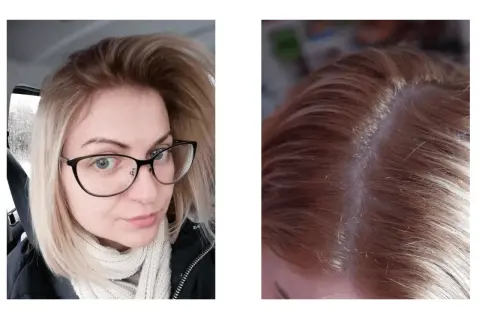Kobieta z okularami i jasnymi, blond włosami. Widoczne odrosty na głowie.