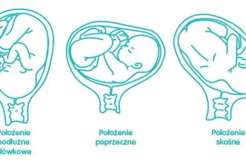 Kiedy płód układa się do porodu i co to oznacza dla mamy?