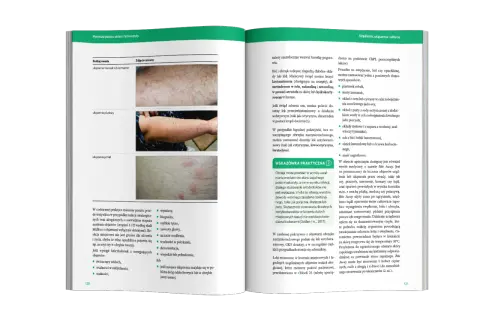 Loperamid: bez recepty czy na receptę? Wszystko, co musisz wiedzieć.