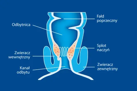 Schemat budowy odbytnicy z zaznaczonym splotem naczyń, który może być przyczyną hemoroidów.