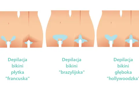 Czy depilatorem laserowym można golić miejsca intymne bez bólu?