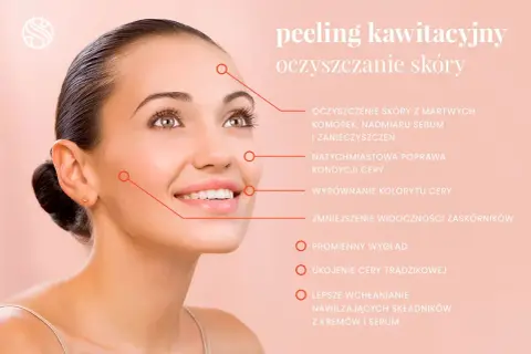 Uśmiechnięta kobieta z czystą cerą. Opisuje peeling kawitacyjny: oczyszczanie skóry krok po kroku, poprawa kondycji, wyrównanie kolorytu, redukcja zaskórników.