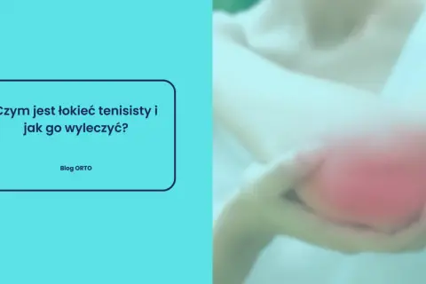 Ból łokcia tenisisty? Na zdjęciu widać zaczerwieniony łokieć, a po lewej stronie tekst: "Czym jest łokieć tenisisty i jak go wyleczyć?".