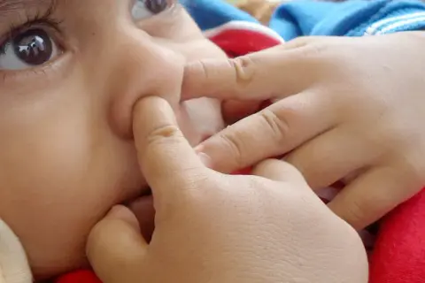 Katar u niemowlaka: Poradnik dla rodziców co robić krok po kroku?