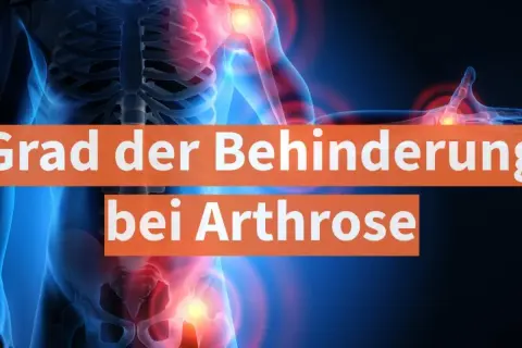 Grafik zeigt menschlichen Körper mit schmerzenden Gelenken. Text: "Grad der Behinderung bei Arthrose".