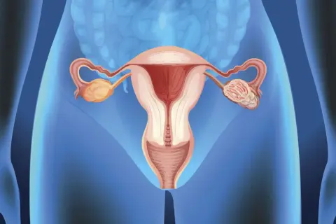 Ilustracja przedstawia kobiece narządy rozrodcze z widocznym jajnikiem, który może być dotknięty przez torbiel kieszonki Rathkego.