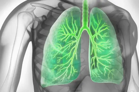 Illustration der Lunge mit Bronchien. Informationen zu Lungenspiegelung Risiken sind wichtig für Patienten.