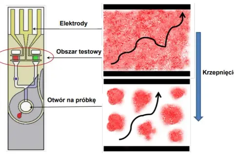 Badanie PT - co to za badanie i dlaczego jest tak ważne?