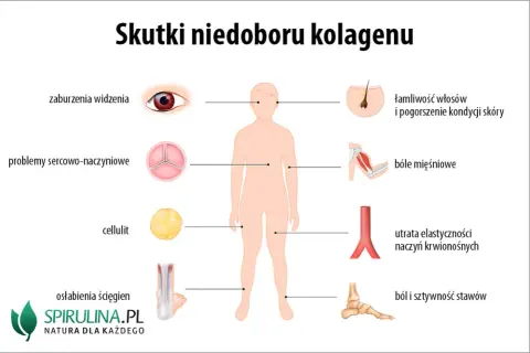 Objawy niedoboru kolagenu: Rozpoznaj i skutecznie uzupełnij!