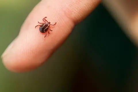 Mały kleszcz na palcu. Czy urwany kleszcz żyje? To pytanie nurtuje wielu po usunięciu pasożyta.