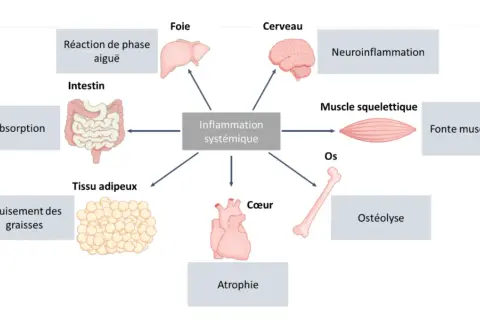 Schéma montrant l'inflammation systémique affectant le muscle squelettique, entraînant une fonte musculaire. D'autres effets incluent le cerveau, le foie, le cœur, les os, l'intestin, le tissu adipeux et la réaction de phase aiguë.