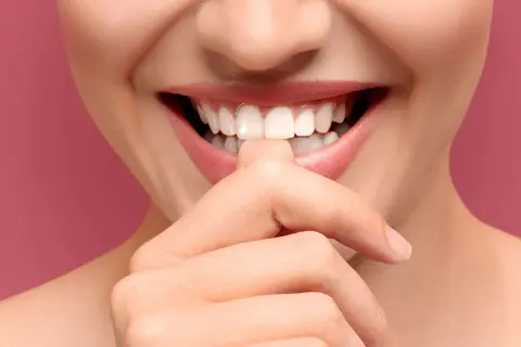 Sonrisa radiante con dientes blancos y perfectos. Incluso se puede blanquear un implante dental para lograr este resultado.