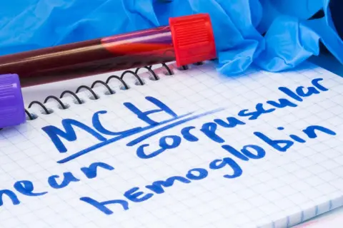 Na notatniku zapisano "MCH - mean corpuscular hemoglobin". Obok probówki z krwią, rękawiczki i stetoskop.