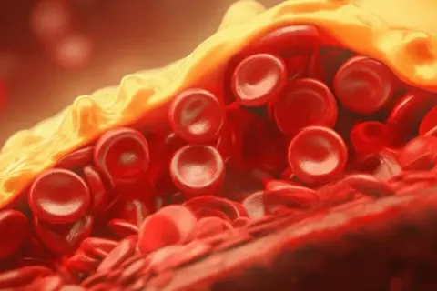 HDL jaki to cholesterol i jego kluczowe znaczenie dla zdrowia serca