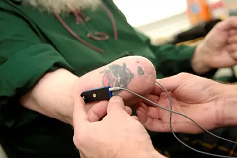 Un uomo con un tatuaggio sulla parte finale dell'avambraccio, forse a seguito di un'amputazione mano, tiene un dispositivo medico.