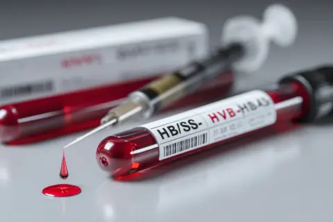 HBsAg: Dodatni czy ujemny? Zrozum swój wynik i zadbaj o wątrobę
