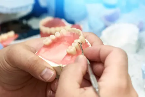 Protetyk stomatologiczny pracuje nad protezą zębową, która może być refundowana przez NFZ.