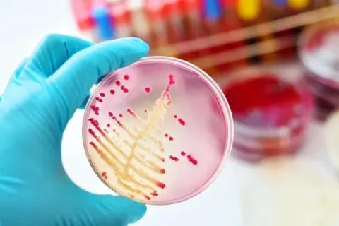 Rękawiczka w niebieskiej rękawiczce trzyma szalkę Petriego z czerwonymi koloniami bakterii, być może Klebsiella pneumoniae, na różowym podłożu.