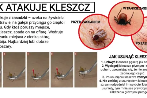 Zdjęcie przedstawia kleszcza **ixodes ricinus** przed, w trakcie i po zassaniu, a także instrukcję usuwania go.