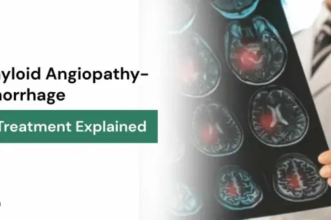 Arzt hält MRT-Aufnahmen, die Hirnblutungen bei CAA (Cerebral Amyloid Angiopathy) zeigen. Informationen zu Symptomen und Behandlung.