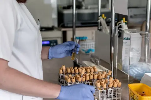 Laborantka w niebieskich rękawiczkach analizuje próbkę, która może zawierać dane o poziomie dehydrogenazy mleczanowej.