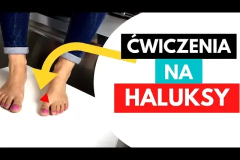 Domowe ćwiczenia na haluksy: Zwalcz ból i zatrzymaj deformację