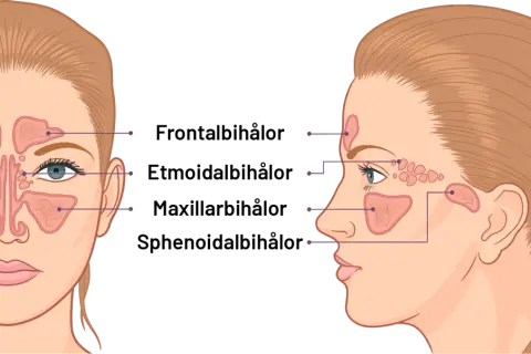 Illustration av bihålorna i ansiktet. Lär dig om bihåleinflammation huskur och hur du kan lindra besvären.