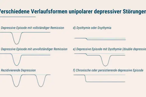 Grafiken zeigen Verläufe von depressiven Episoden, von vollständiger Remission bis zu chronischen Formen, die major depression illustrieren.