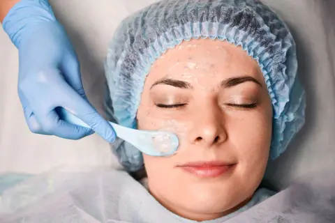 Una mano enguantada aplica una mascarilla en el rostro de una mujer, parte de un tratamiento de peeling químico para renovar la piel.