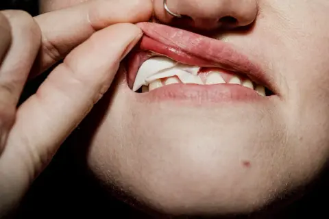 En person tar bort en snusprilla från munnen. Kanske är personen allergisk mot snus och upplever irritation.