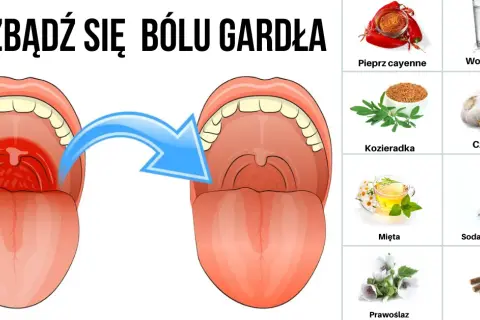 Angina? Co zjeść na obiad, by gardło przestało boleć?